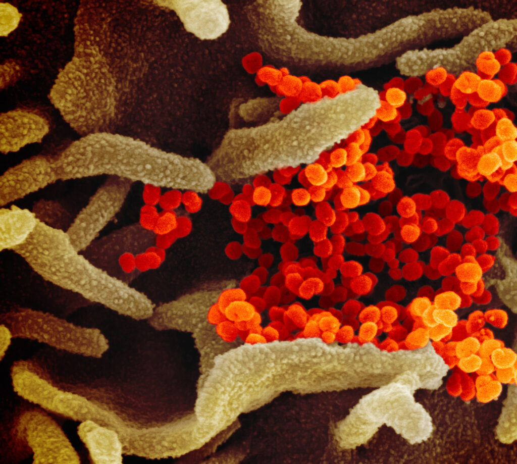 Scanning electron microscope image showing sars