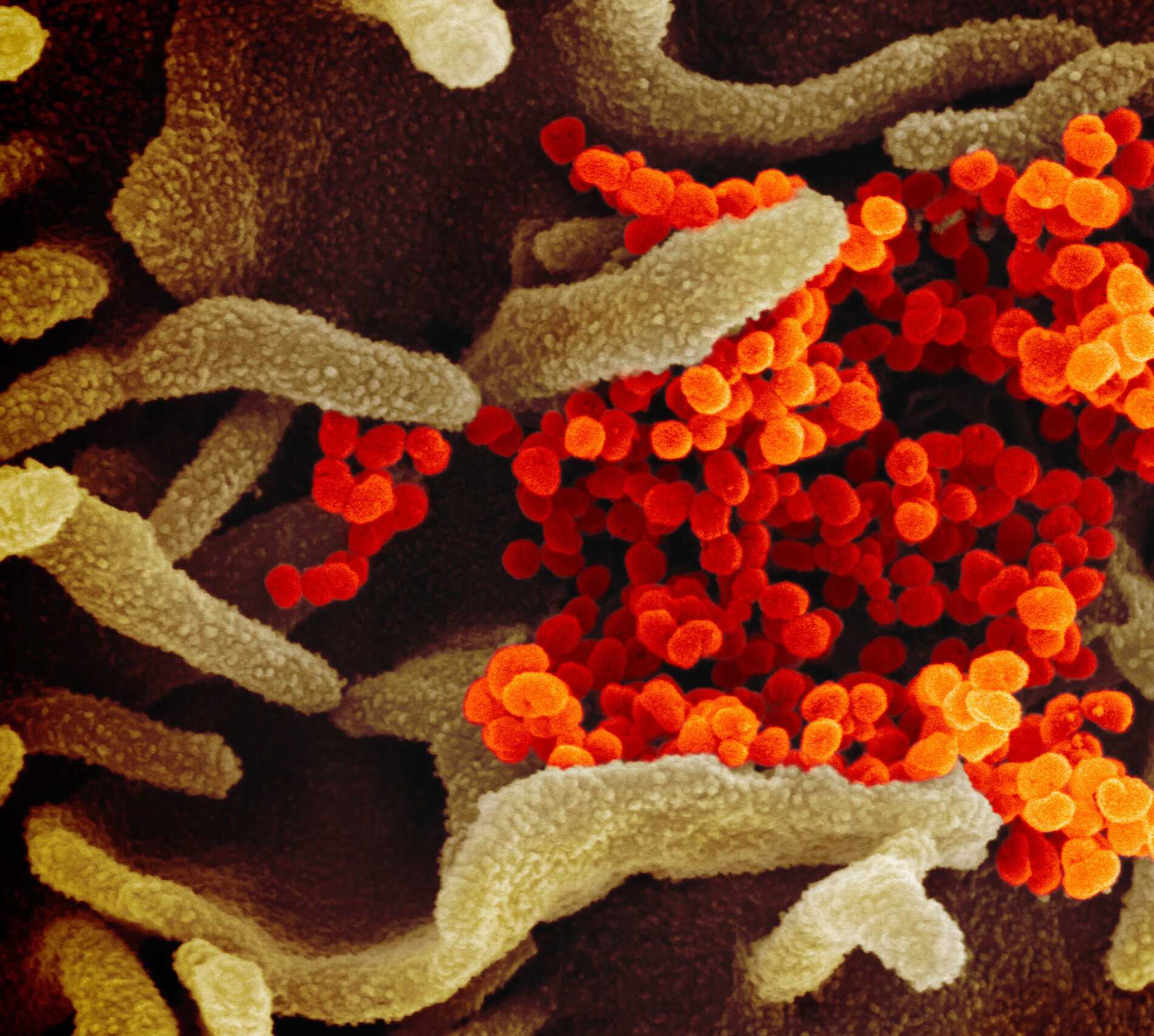 Scanning electron microscope image showing sars